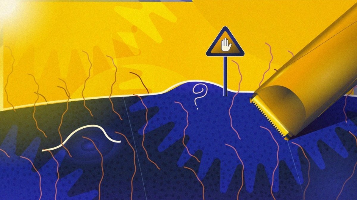 Eerste hulp bij schaamhaar scheren: wat te doen bij bultjes, jeuk en ingegroeide haren | BALZY